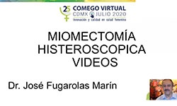 Miomectomía Histeroscopica