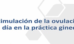 Estimulación de la ovulación. El día a día en la práctica ginecológica.
