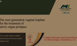 Implante SRS: innovación en el tratamiento quirúrgico del prolapso de organos pélvicos