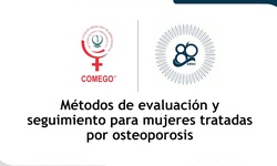 Métodos de evaluación y seguimiento para mujeres tratadas por osteoporosis