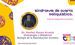 Criterios diagnósticos actuales de diagnóstico del Síndrome de Ovario Poliquístico.