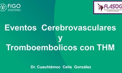 THM y riesgo de eventos cerebrovasculares y tromboembolismo