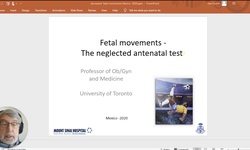 Actualización sobre el significado del aumento y la disminución de los movimientos fetales