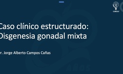 Caso clínico estructurado: Disgenesia gonadal mixtat