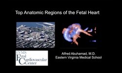 Top anatomic regions in the fetal heart