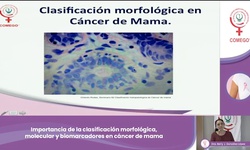 Importancia de la clasificación morfológica, molecular y biomarcadores en cáncer de mama